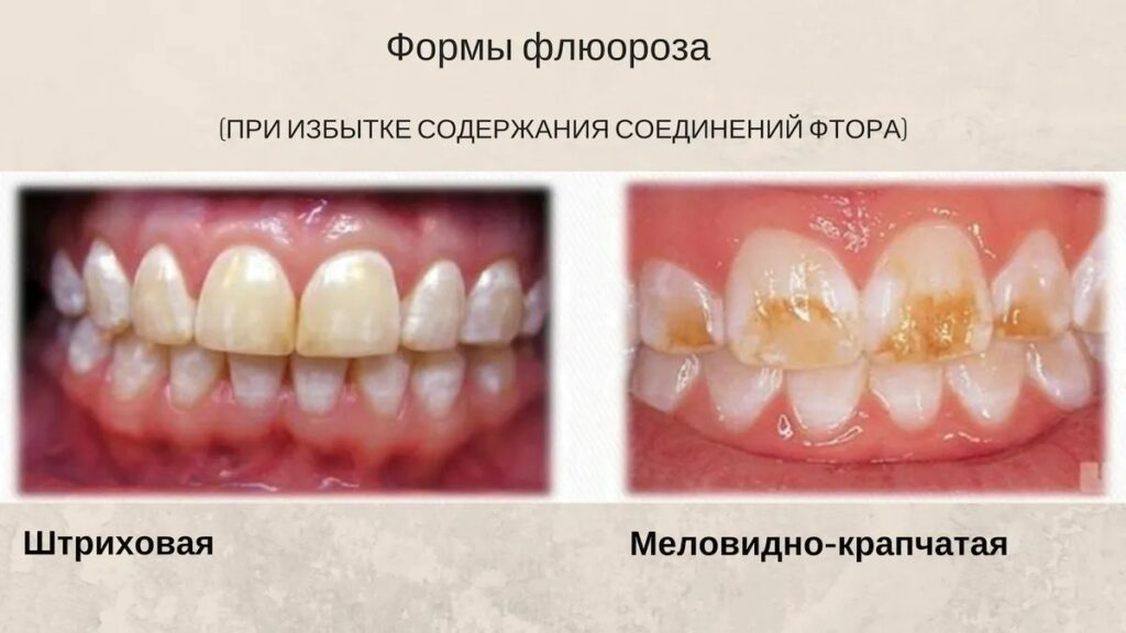 Полезно ли чистить зубы